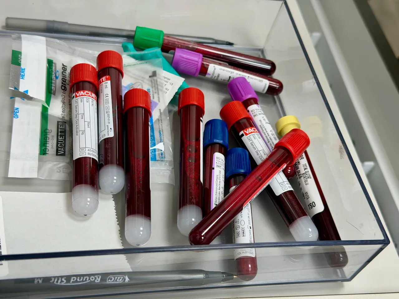 Blood test samples in a haematology laboratory