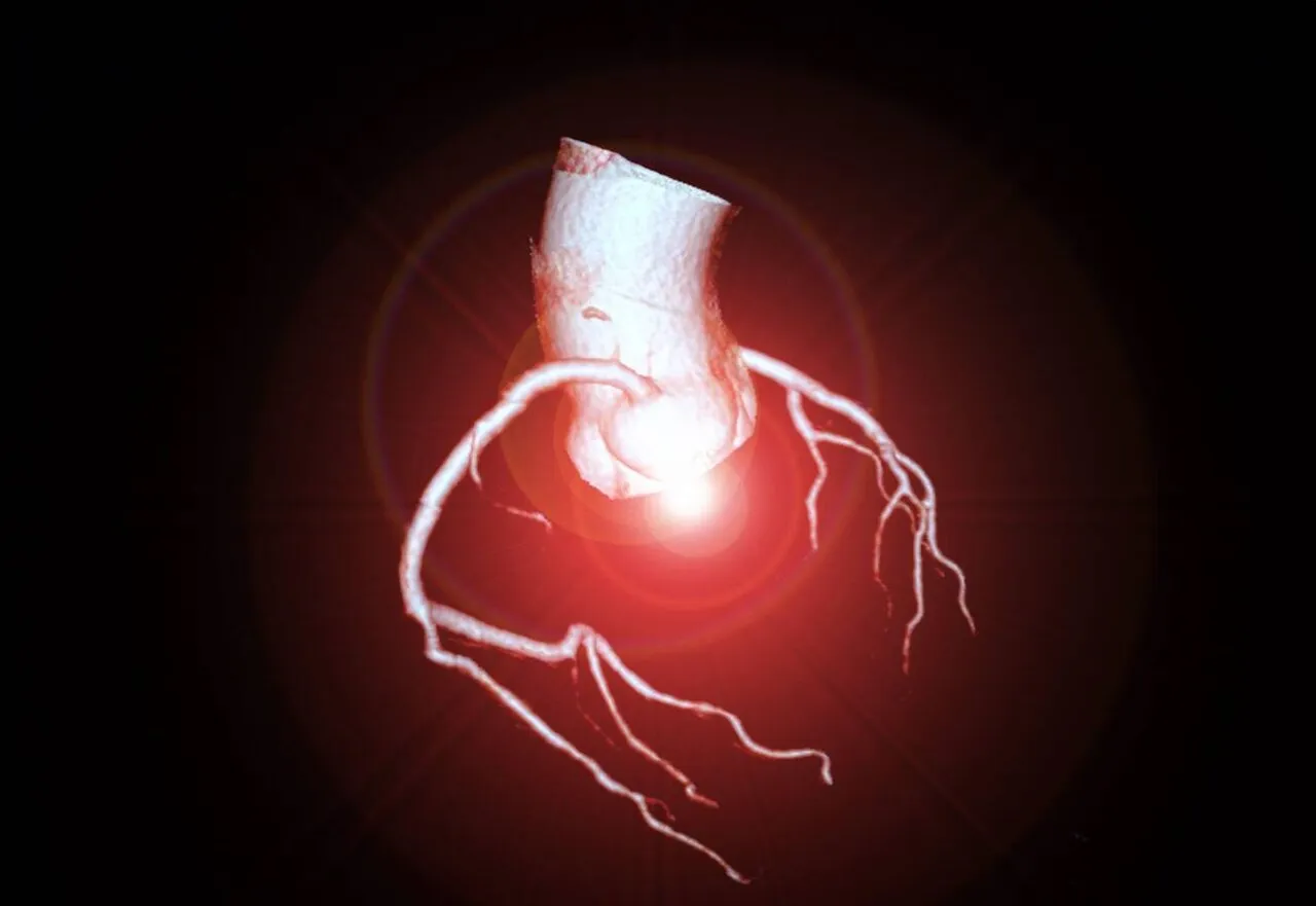 CT coronary artery imaging, a key topic at ESC Congress
